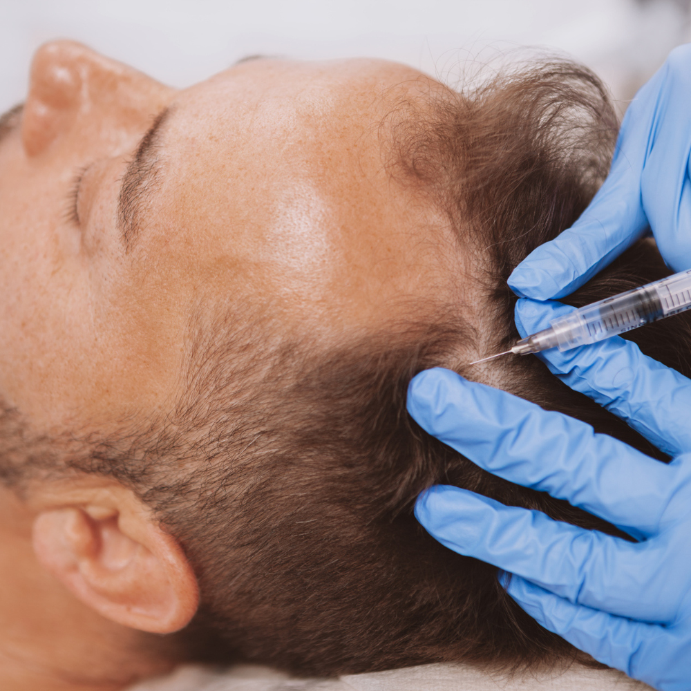 What\'s Scarier to You: Needles or Going Bald?