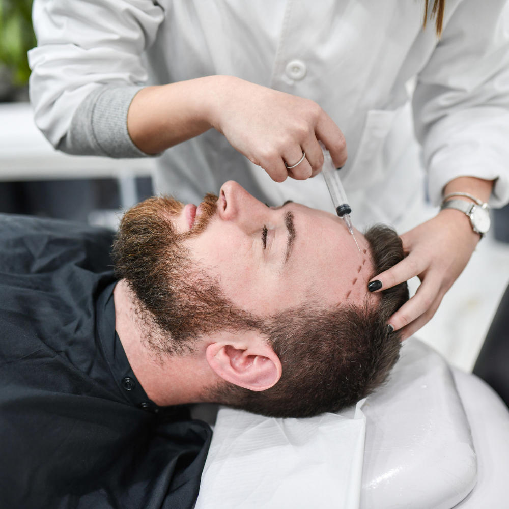 Hair Transplant Tourism Is On the Rise — But It Comes With Risks