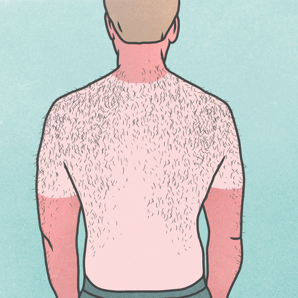 A Comprehensive Guide to Caring for Your Sunburnt Skin