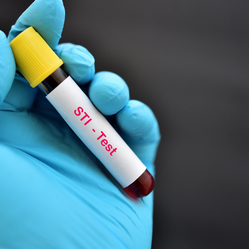 The Pros & Cons of Taking a Home STI Test, Revealed